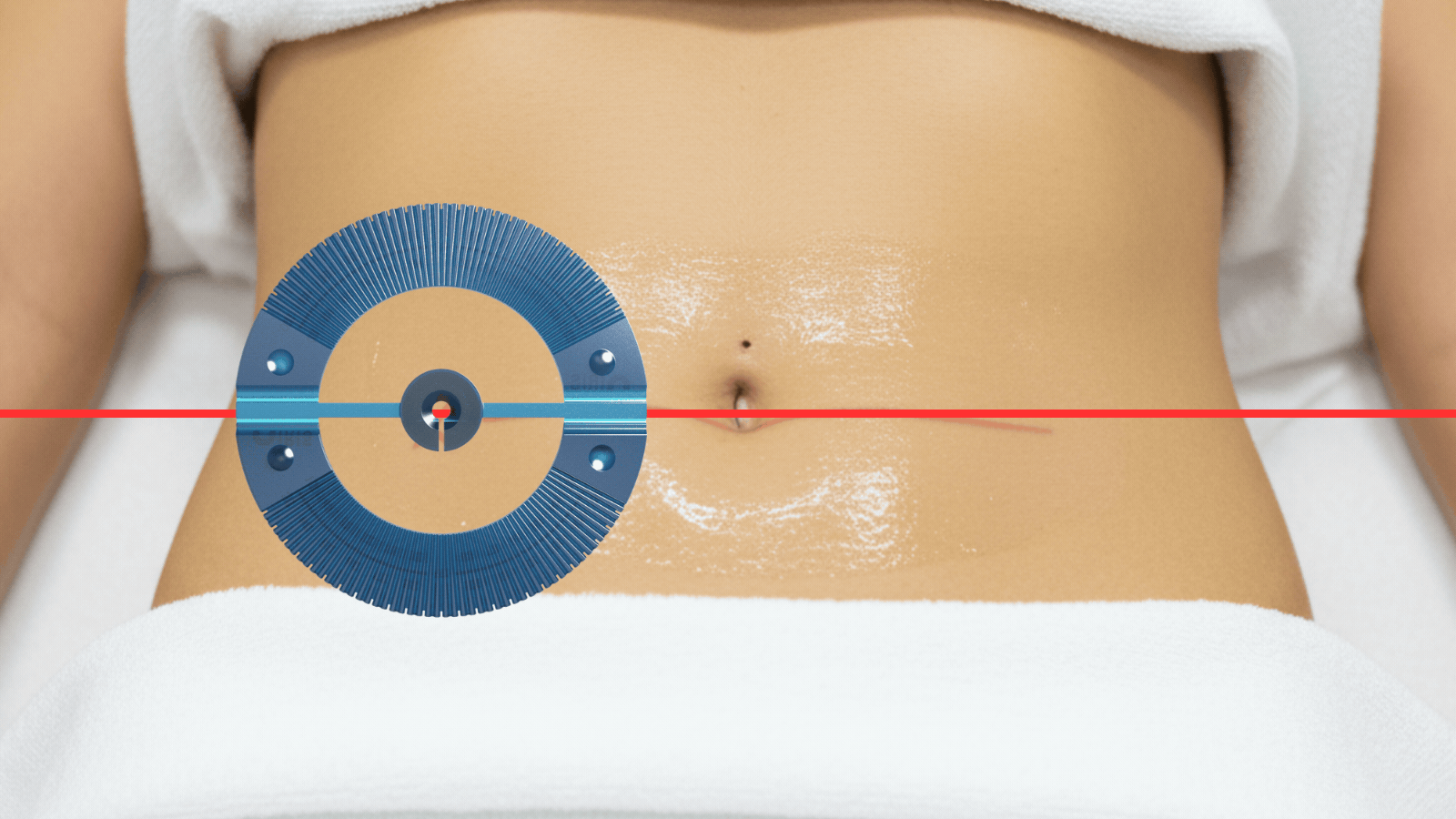IRIS Device